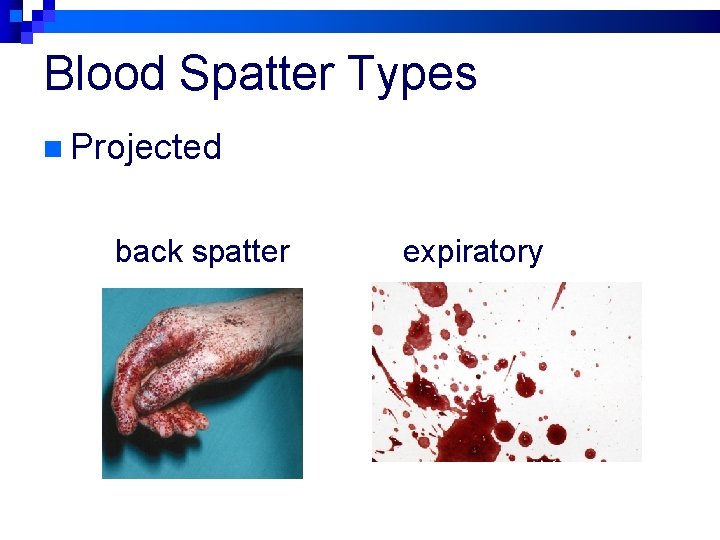 Blood Spatter Types n Projected back spatter expiratory 