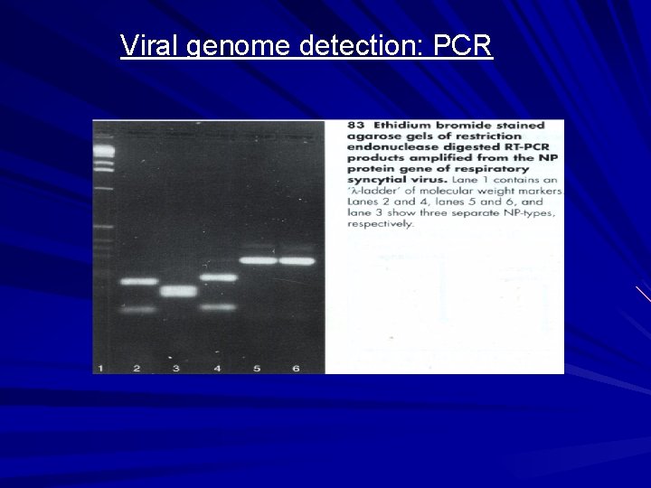 Viral genome detection: PCR 