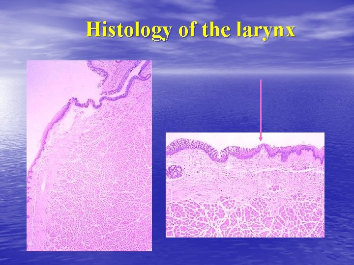 Histology of the larynx Histology of the larynx