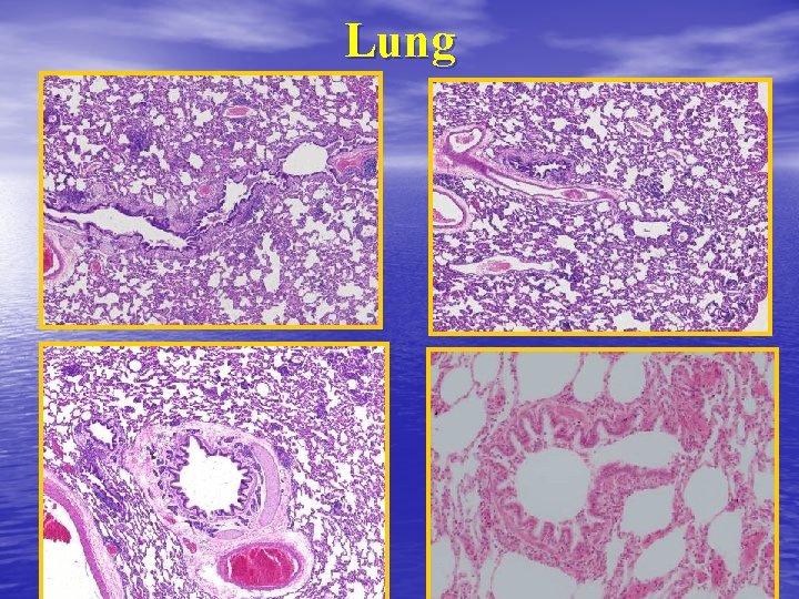 Lung Lung