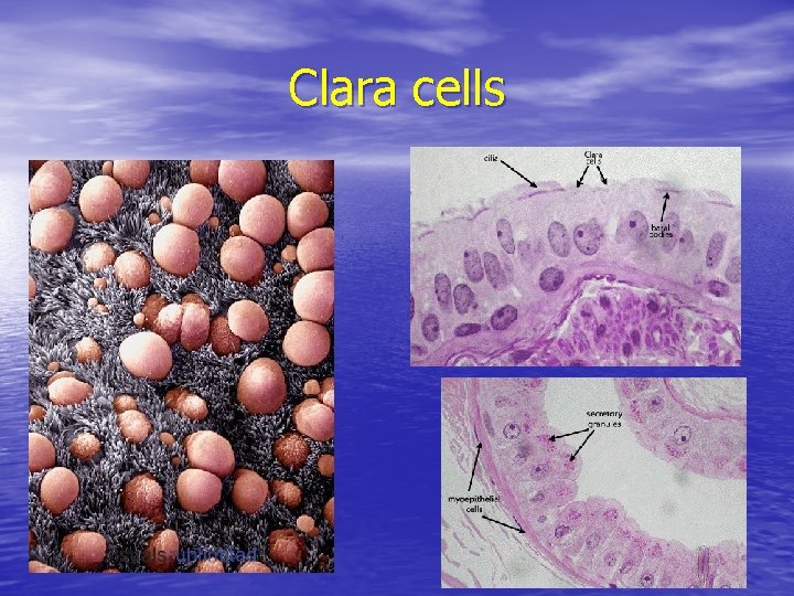 Clara cells Clara cells