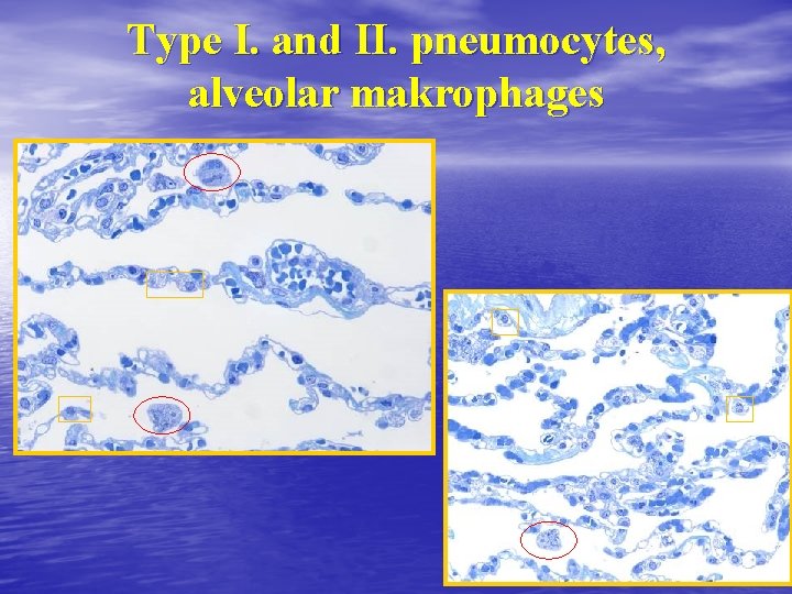 Type I. and II. pneumocytes, alveolar makrophages Type I. and II. pneumocytes, alveolar makrophages