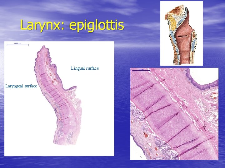 Larynx: epiglottis Lingual surface Laryngeal surface Larynx: epiglottis Lingual surface Laryngeal surface