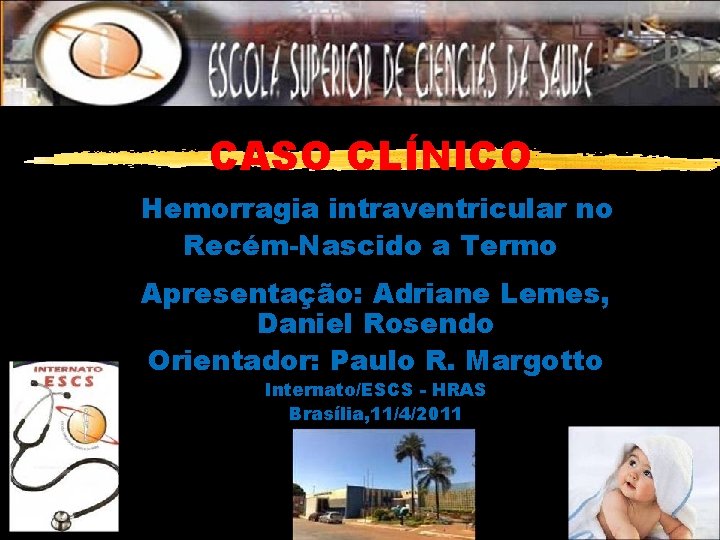 CASO CLÍNICO Hemorragia intraventricular no Recém-Nascido a Termo Apresentação: Adriane Lemes, Daniel Rosendo Orientador: