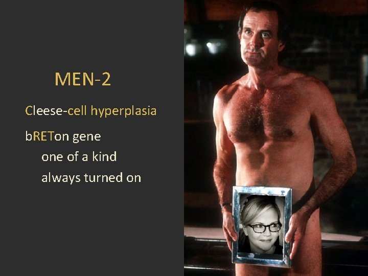 MEN-2 Cleese-cell hyperplasia b. RETon gene of a kind always turned on 