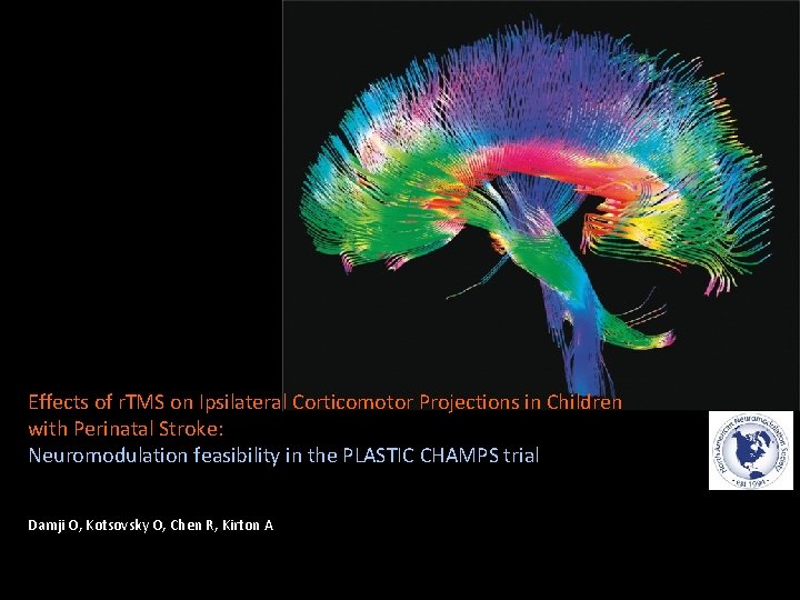 Effects of r. TMS on Ipsilateral Corticomotor Projections in Children with Perinatal Stroke: Neuromodulation