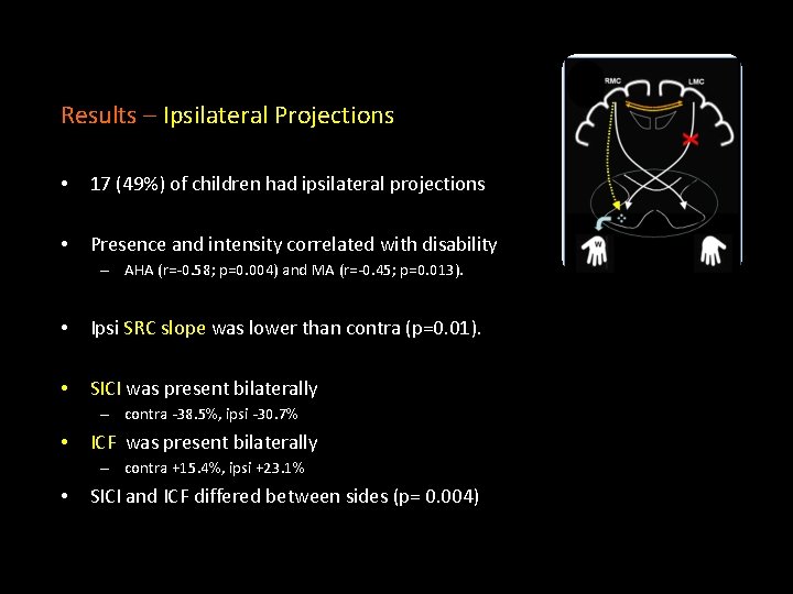 Results – Ipsilateral Projections • 17 (49%) of children had ipsilateral projections • Presence