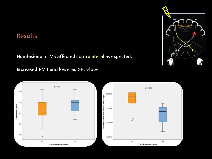 Results Non-lesional r. TMS affected contralateral as expected: Increased RMT and lowered SRC slope