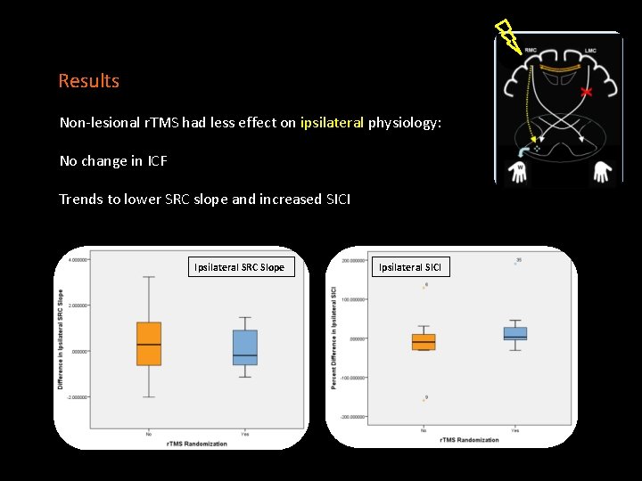 Results Non-lesional r. TMS had less effect on ipsilateral physiology: No change in ICF