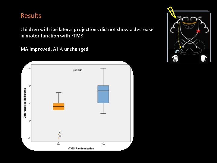 Results Children with ipsilateral projections did not show a decrease in motor function with