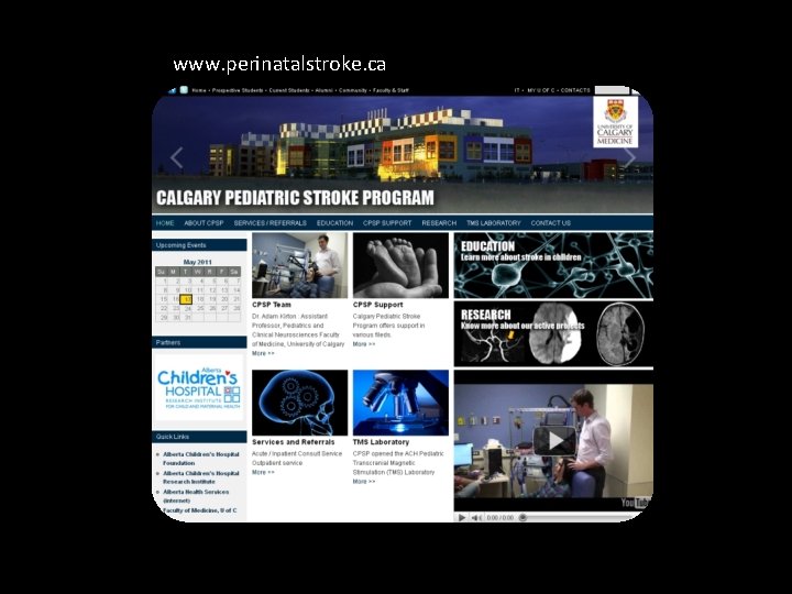 www. perinatalstroke. ca 