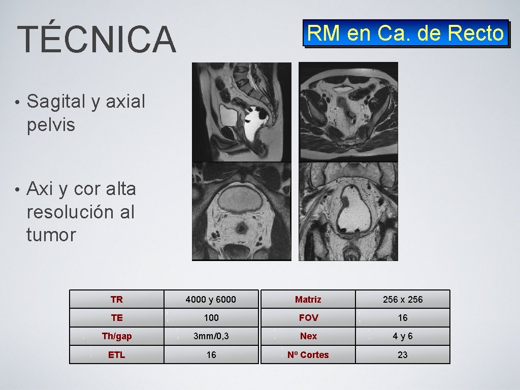 TÉCNICA • Sagital y axial pelvis • Axi y cor alta resolución al tumor