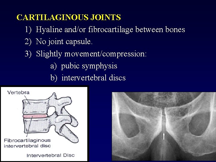 CARTILAGINOUS JOINTS 1) Hyaline and/or fibrocartilage between bones 2) No joint capsule. 3) Slightly
