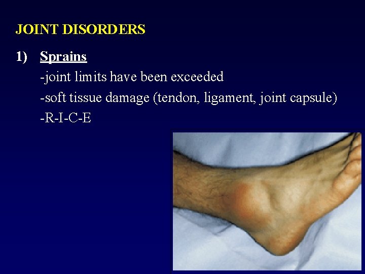 JOINT DISORDERS 1) Sprains -joint limits have been exceeded -soft tissue damage (tendon, ligament,