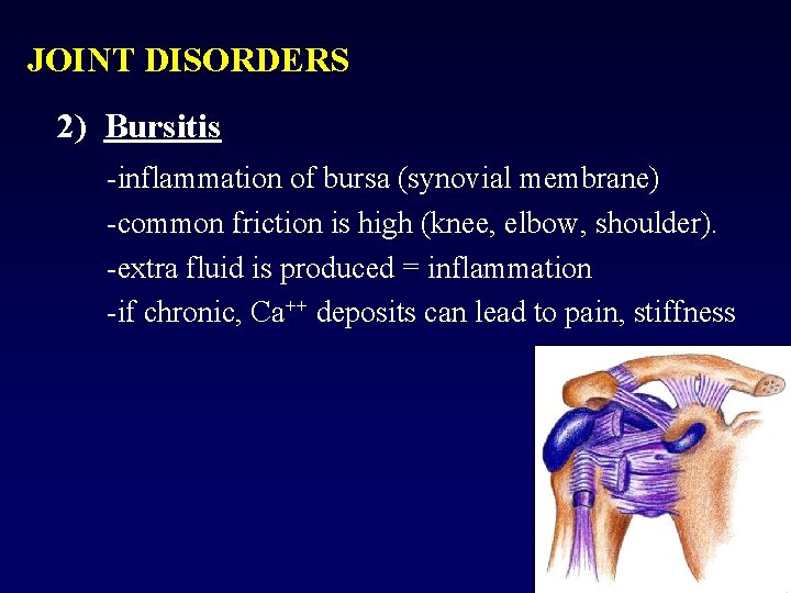 JOINT DISORDERS 2) Bursitis -inflammation of bursa (synovial membrane) -common friction is high (knee,