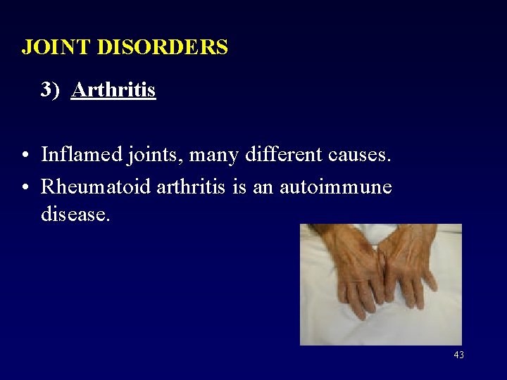 JOINT DISORDERS 3) Arthritis • Inflamed joints, many different causes. • Rheumatoid arthritis is