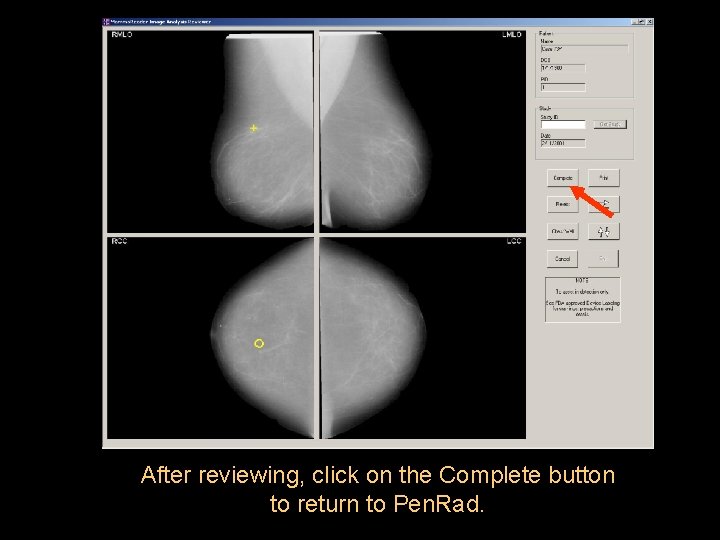 After reviewing, click on the Complete button to return to Pen. Rad. 