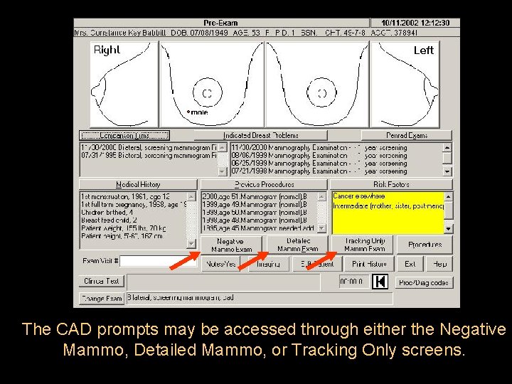 The CAD prompts may be accessed through either the Negative Mammo, Detailed Mammo, or