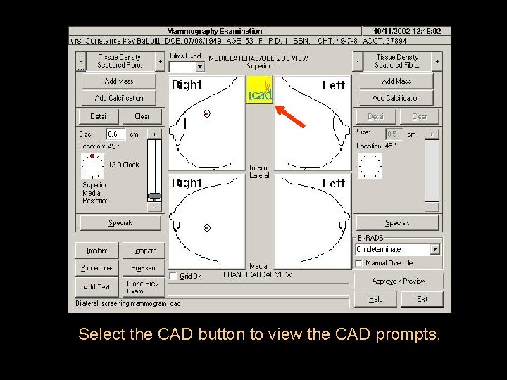 Select the CAD button to view the CAD prompts. 