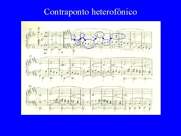 Contraponto heterofônico 