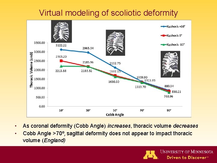 Virtual modeling of scoliotic deformity • • As coronal deformity (Cobb Angle) increases, thoracic