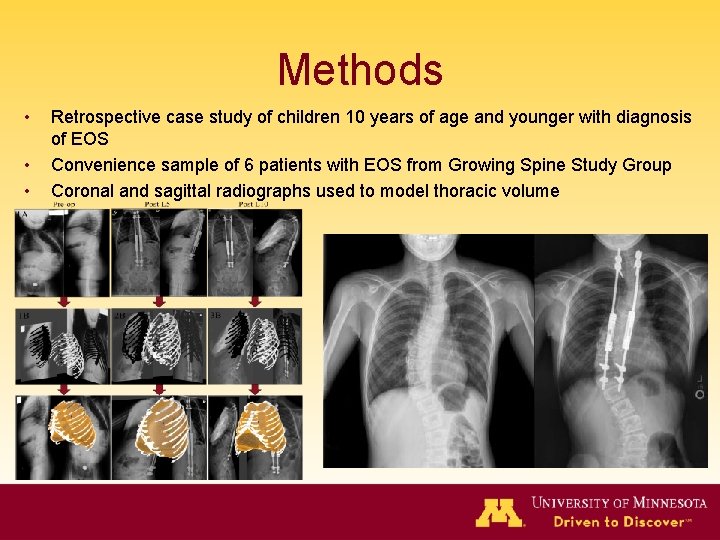 Methods • • • Retrospective case study of children 10 years of age and