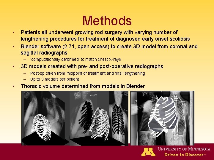 Methods • • Patients all underwent growing rod surgery with varying number of lengthening