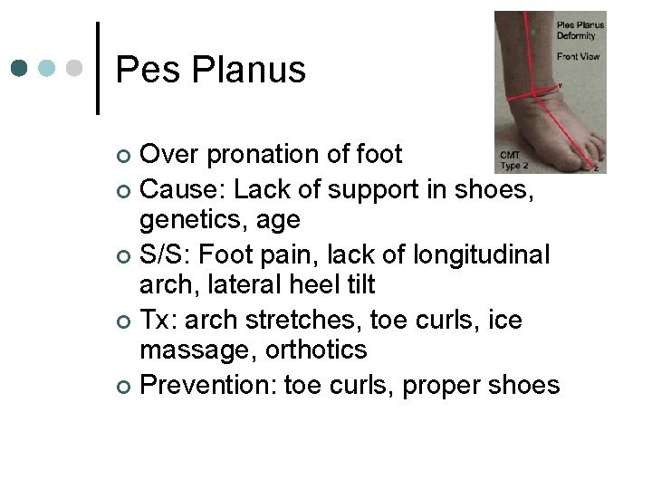 Pes Planus Over pronation of foot ¢ Cause: Lack of support in shoes, genetics,