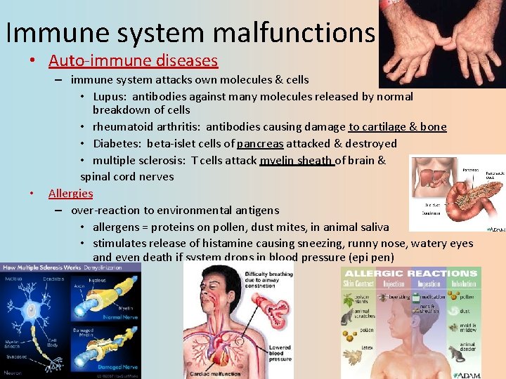 Immune system malfunctions • Auto-immune diseases • – immune system attacks own molecules &