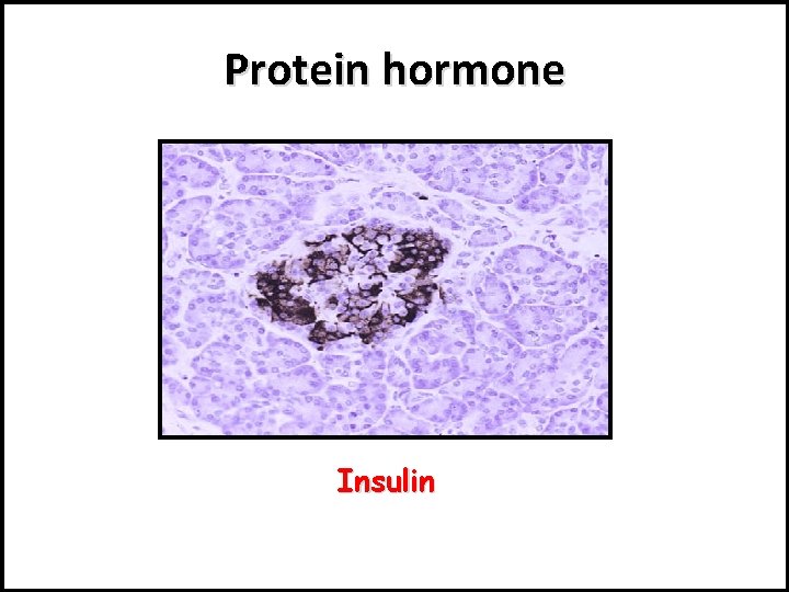 Protein hormone Insulin 