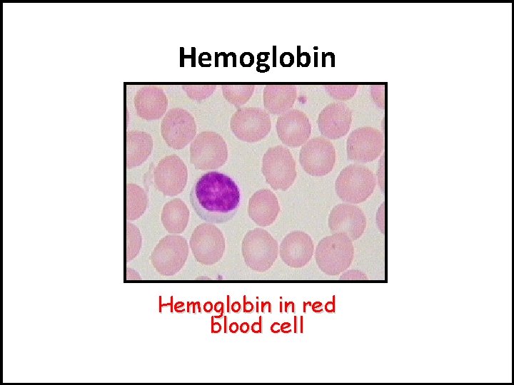 Hemoglobin in red blood cell 