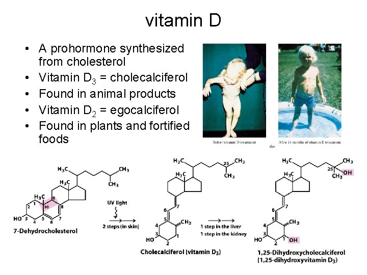 vitamin D • A prohormone synthesized from cholesterol • Vitamin D 3 = cholecalciferol