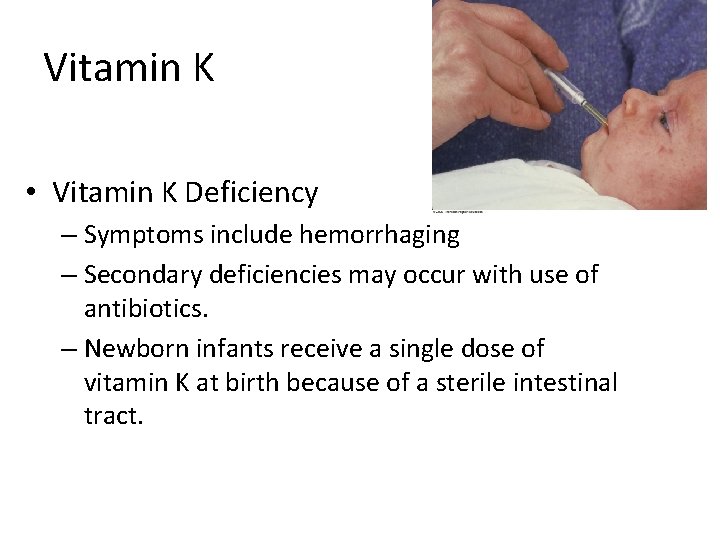 Vitamin K • Vitamin K Deficiency – Symptoms include hemorrhaging – Secondary deficiencies may