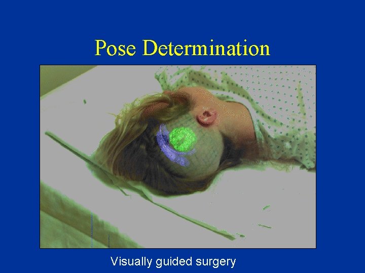 Pose Determination Visually guided surgery 