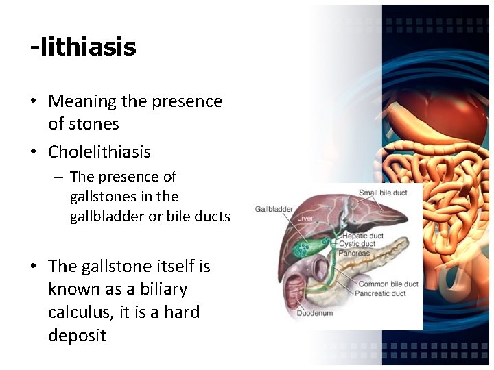 -lithiasis • Meaning the presence of stones • Cholelithiasis – The presence of gallstones