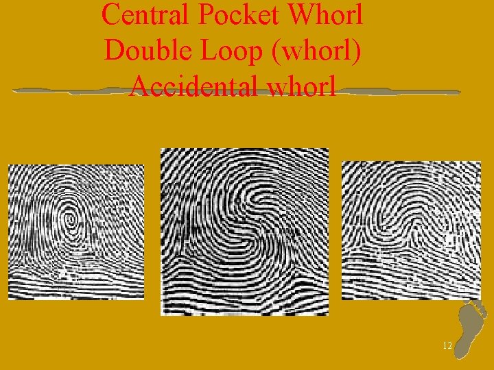 Central Pocket Whorl Double Loop (whorl) Accidental whorl 12 
