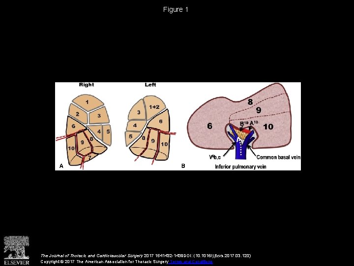 Figure 1 The Journal of Thoracic and Cardiovascular Surgery 2017 1541432 -1439 DOI: (10.