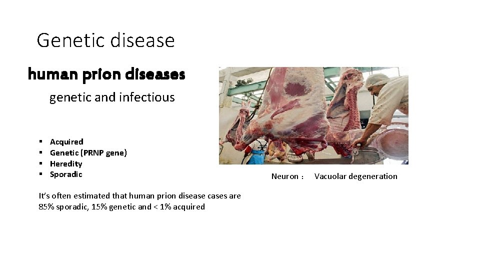 Genetic disease human prion diseases genetic and infectious § § Acquired Genetic (PRNP gene)