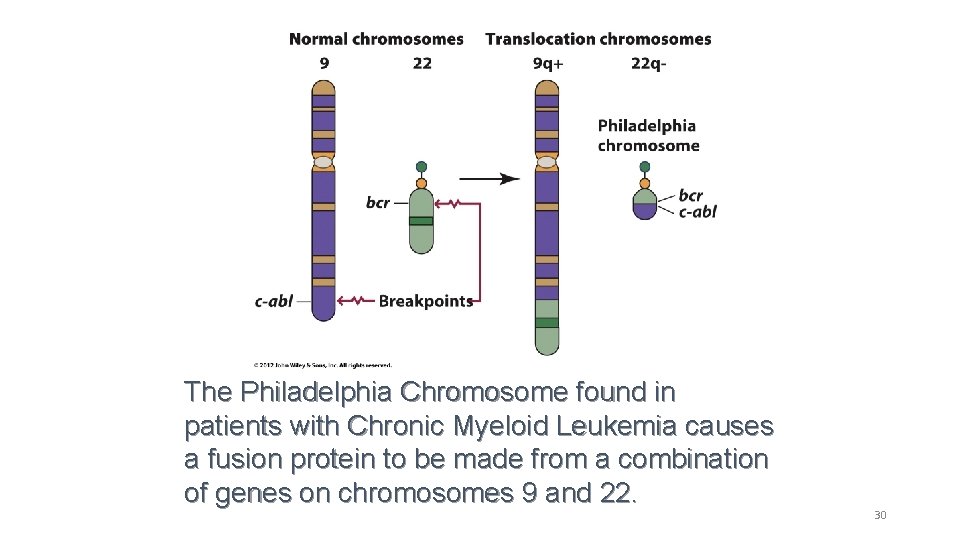 The Philadelphia Chromosome found in patients with Chronic Myeloid Leukemia causes a fusion protein