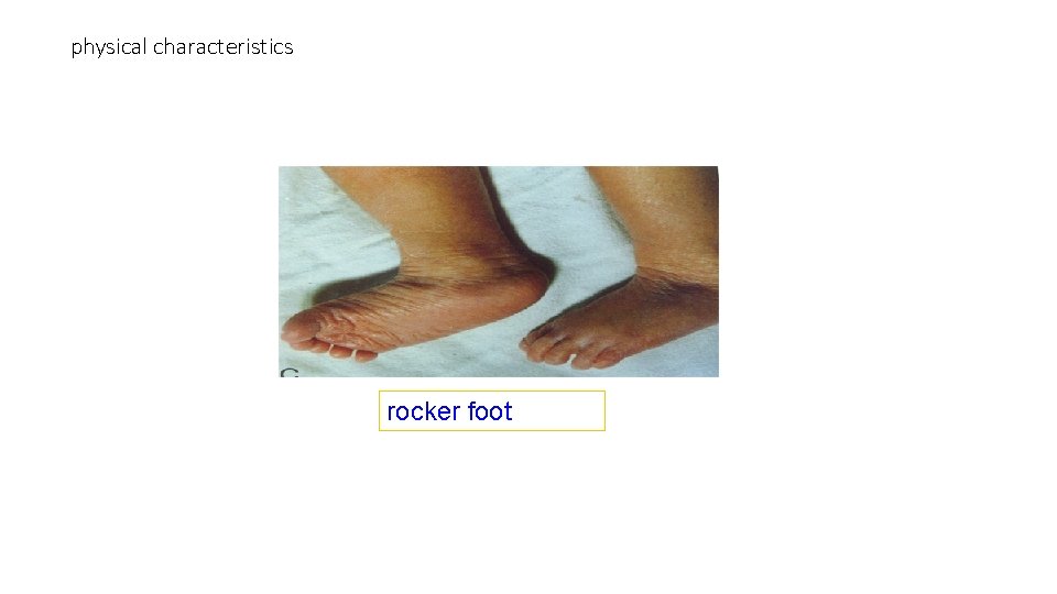 physical characteristics rocker foot 