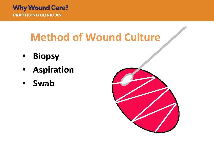 Method of Wound Culture • Biopsy • Aspiration • Swab © Dot Weir -