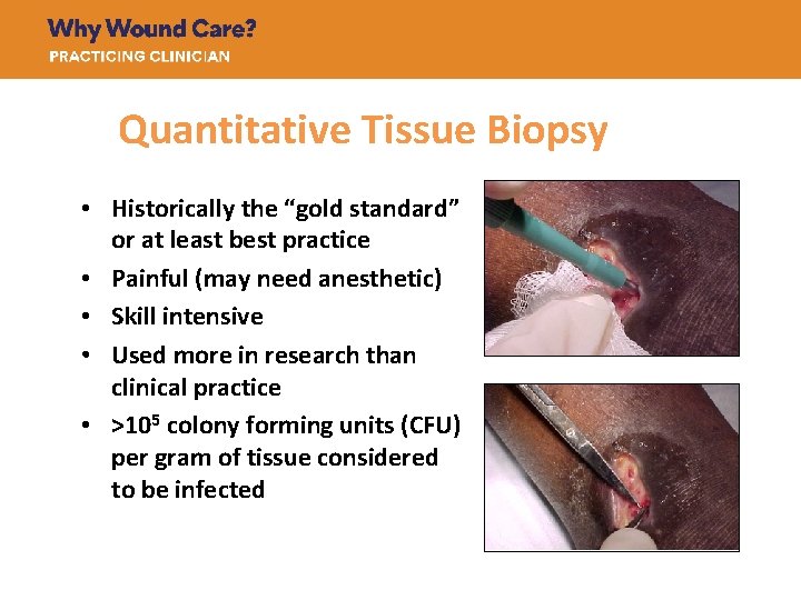 Quantitative Tissue Biopsy • Historically the “gold standard” or at least best practice •