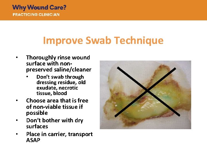 Improve Swab Technique • Thoroughly rinse wound surface with nonpreserved saline/cleaner • • Don’t