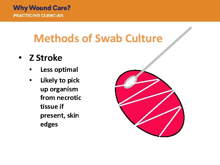 Methods of Swab Culture • Z Stroke • • Less optimal Likely to pick