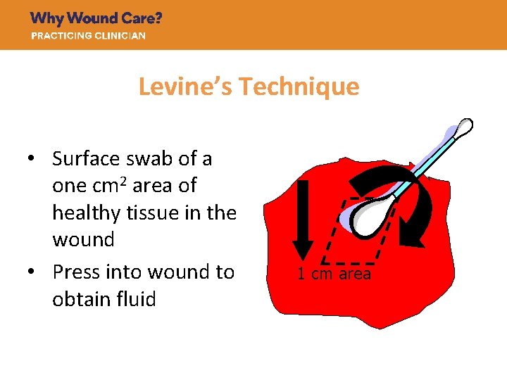 Levine’s Technique • Surface swab of a one cm 2 area of healthy tissue