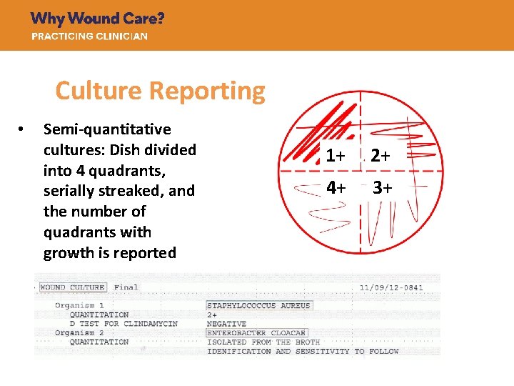 Culture Reporting • Semi-quantitative cultures: Dish divided into 4 quadrants, serially streaked, and the