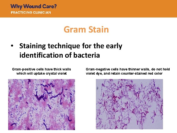 Gram Stain • Staining technique for the early identification of bacteria Gram-positive cells have