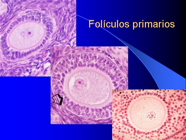 Folículos primarios 