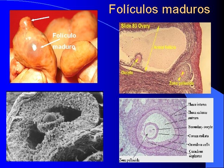 Folículos maduros Folículo maduro 