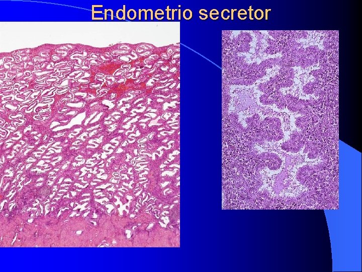 Endometrio secretor 